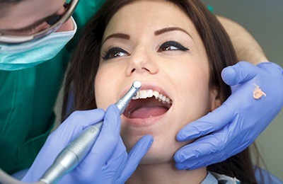 dental cleaning