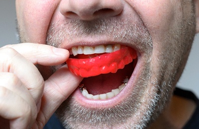 Close-up of mouthguard