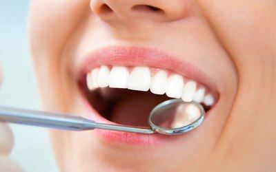 Close-up of woman’s smile with dental mirror