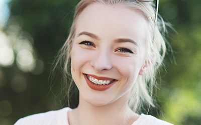 Woman with Six Month Smiles braces
