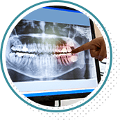 Panoramic dental x-rays