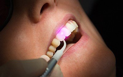 Patient receiving laser dentistry treatment